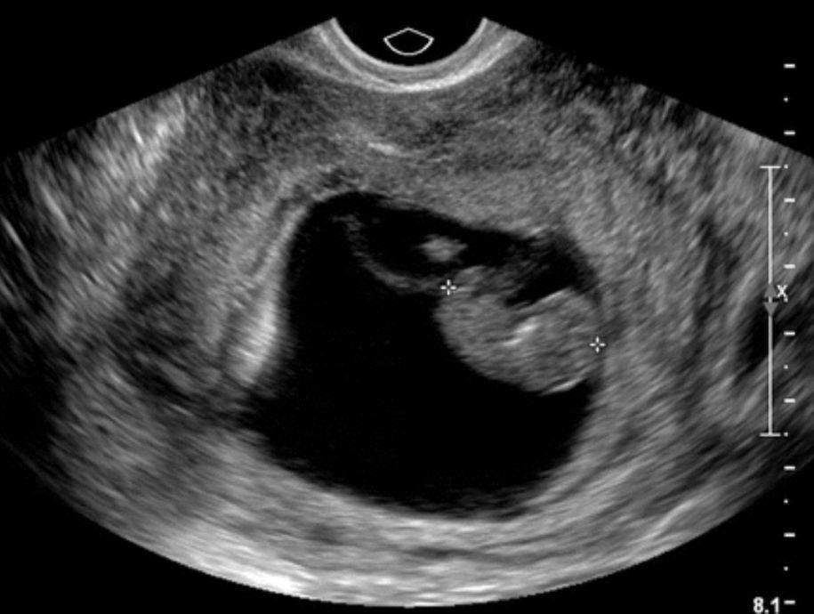 your-fist-scan